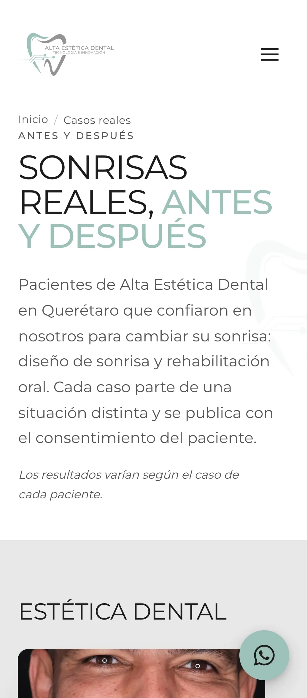 Casos del sitio de Alta Estética Dental, en teléfono.