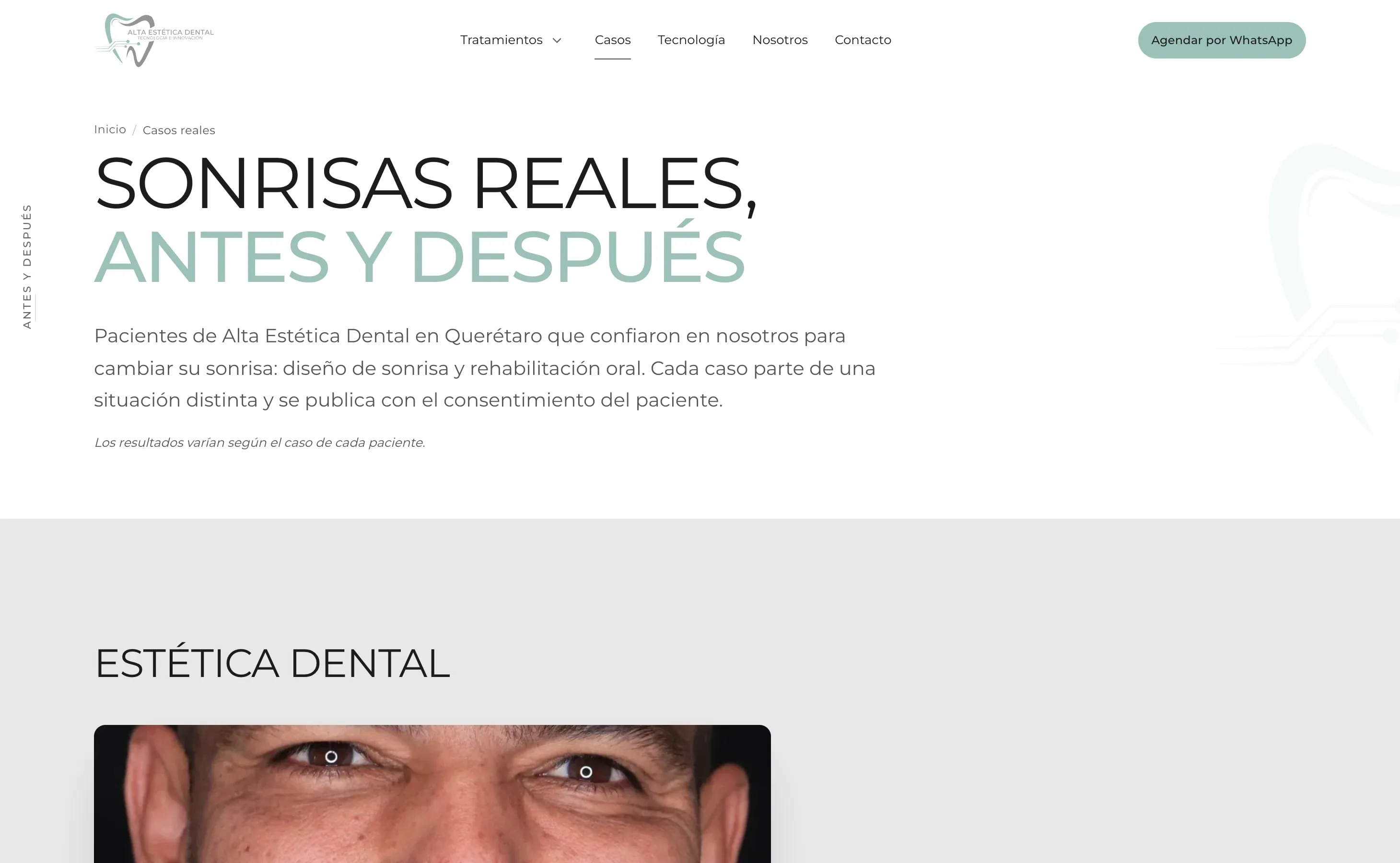 Casos del sitio de Alta Estética Dental, en escritorio.